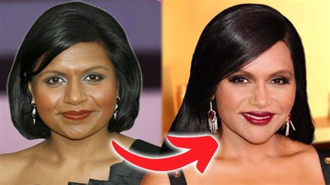 Mindy Kaling’s Transformative Journey: Plastic Surgery ...